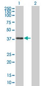 PLA2G4B Antibody in Western Blot (WB)
