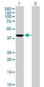 PLA2G4B Antibody in Western Blot (WB)