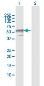 B4GALT3 Polyclonal Antibody, MaxPab™