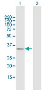 B4GALT2 Antibody in Western Blot (WB)