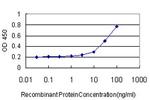 B3GALT2 Antibody in ELISA (ELISA)