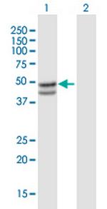 SERPINB7 Polyclonal Antibody, MaxPab™