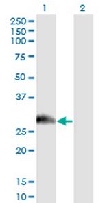 PAGE1 Monoclonal Antibody (6G6)