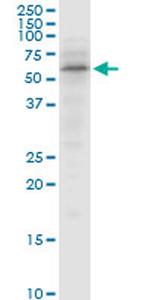 SNX4 Antibody in Western Blot (WB)