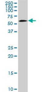 SNX4 Antibody in Western Blot (WB)