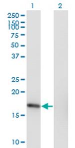 SNX3 Monoclonal Antibody (3A9)