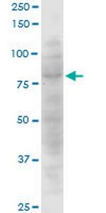 CTNNAL1 Monoclonal Antibody (3C8)