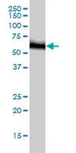 RNMT Monoclonal Antibody (3H3-1D12)