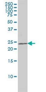CRADD Monoclonal Antibody (1F8)