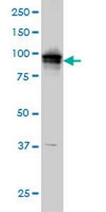 ADAM9 Monoclonal Antibody (3E6)