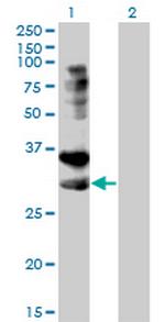 TNFRSF14 Monoclonal Antibody (2G6-2C7)
