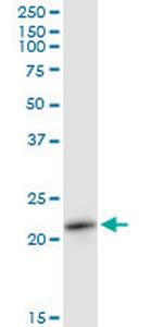 RAB11A Polyclonal Antibody, MaxPab™