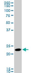 RAB11A Monoclonal Antibody (1F7-2A8)