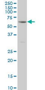 RIPK2 Monoclonal Antibody (6F7)