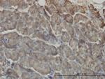 RIPK2 Monoclonal Antibody (7F5)