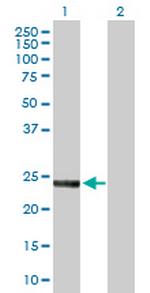 SNAP23 Antibody in Western Blot (WB)