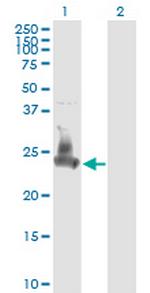 SNAP23 Monoclonal Antibody (2F5-3D4)