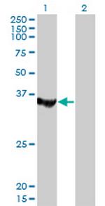 MTMR1 Monoclonal Antibody (1F10)
