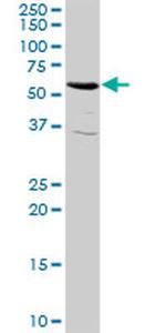 RIOK3 Antibody in Western Blot (WB)