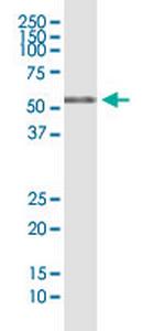 RIOK3 Monoclonal Antibody (4A12-1D2)