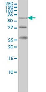 RIOK3 Antibody in Western Blot (WB)
