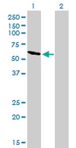RIOK3 Antibody in Western Blot (WB)