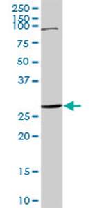 TNFRSF18 Antibody in Western Blot (WB)