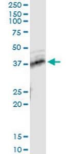 TNFRSF10B Monoclonal Antibody (2D6)