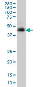 TNFRSF10A Monoclonal Antibody (2E8)
