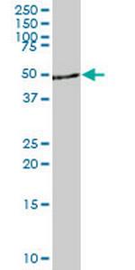 DYRK4 Monoclonal Antibody (3B9)