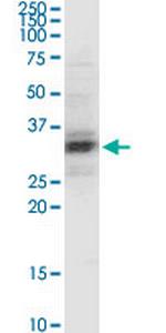 PEX11A Monoclonal Antibody (3B1)