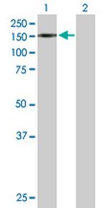 TRIM24 Antibody in Western Blot (WB)