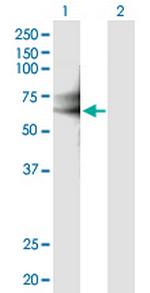 IL18RAP Antibody in Western Blot (WB)