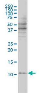 BANF1 Monoclonal Antibody (3F10-4G12)