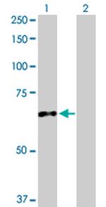 CES2 Polyclonal Antibody, MaxPab™