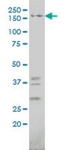 IQGAP1 Monoclonal Antibody (2C5)