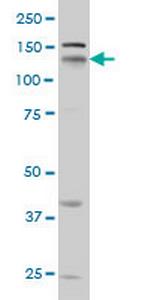NRP1 Antibody in Western Blot (WB)