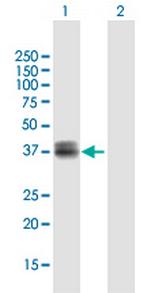 WISP3 Polyclonal Antibody, MaxPab™