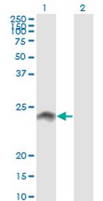 WISP2 Monoclonal Antibody (3D10)