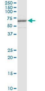 HDAC3 Monoclonal Antibody (2F9-4B7)