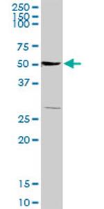 TSC22D1 Antibody in Western Blot (WB)