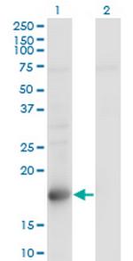 TSC22D1 Monoclonal Antibody (1G7)