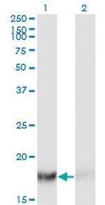 TSC22D1 Monoclonal Antibody (2E2)