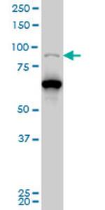 PCAF Antibody in Western Blot (WB)