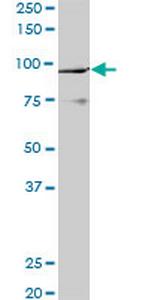 PCAF Monoclonal Antibody (5E5)