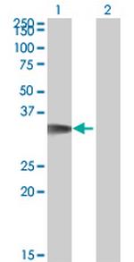 CDK5R1 Monoclonal Antibody (4G11)