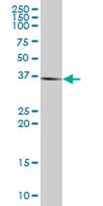 STK19 Antibody in Western Blot (WB)