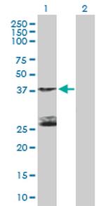 STK19 Polyclonal Antibody, MaxPab™
