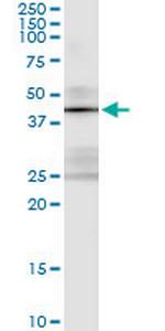 STK19 Monoclonal Antibody (4E11)