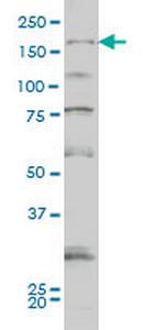 SYNJ1 Monoclonal Antibody (1A2)